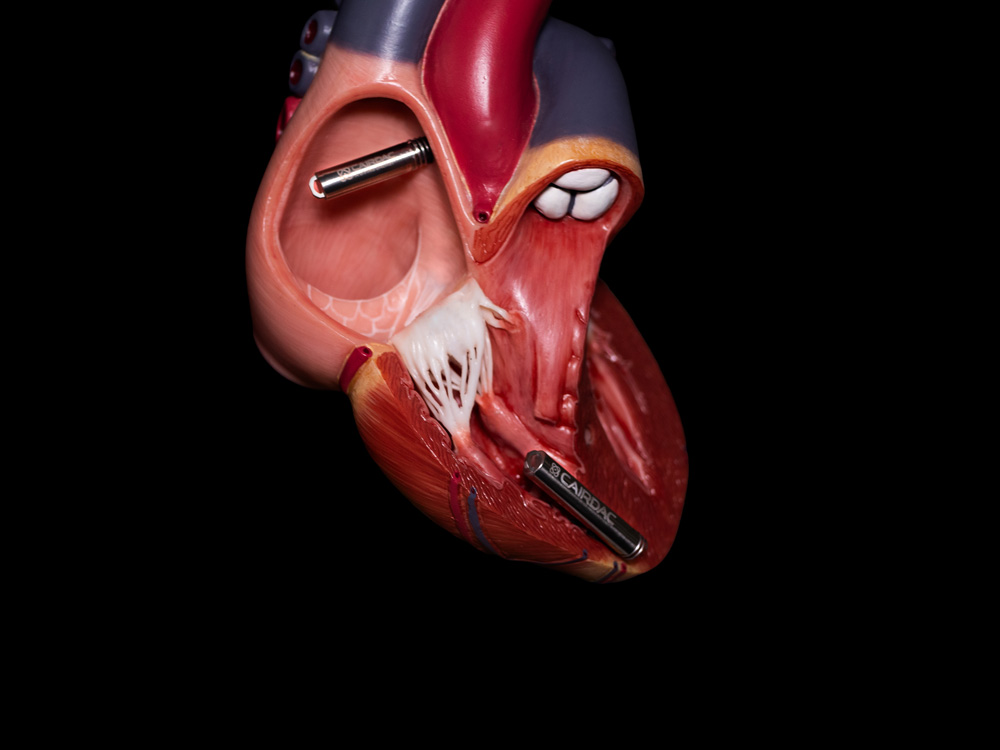 Cardiac anatomy with ALPS device
