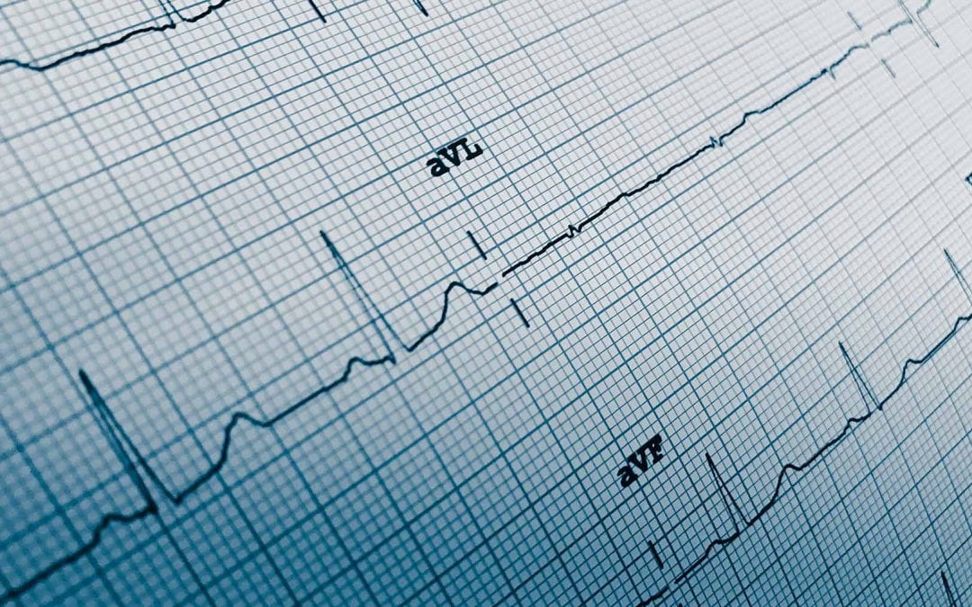 Evaluation of Three-Dimensional Accelerometers for the Study of Left Ventricular Contractility