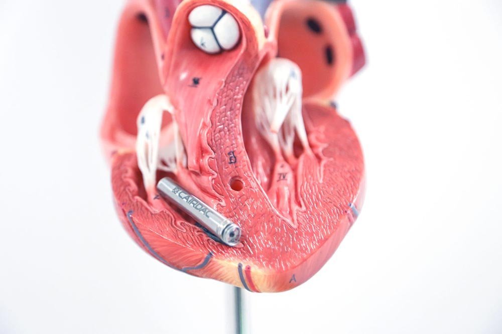 Zoom Anatomic Heart with Cairdac's pacemaker Zoom Anatomic Heart with Cairdac's pacemaker