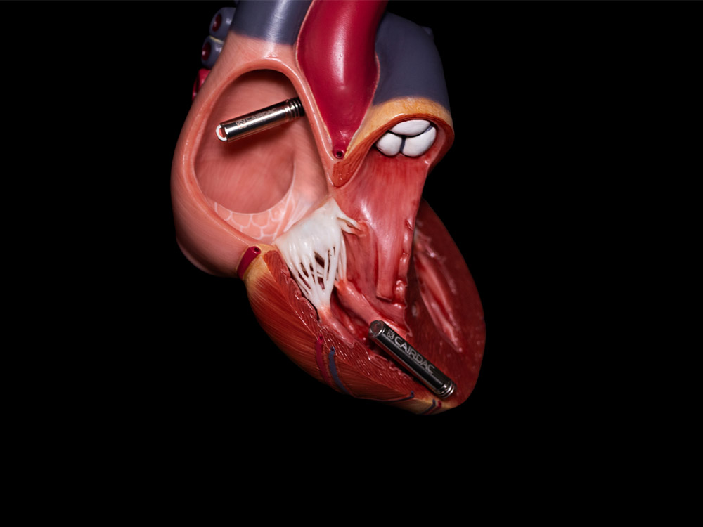 Heart Zoom Anatomic Heart with Cairdac's pacemaker